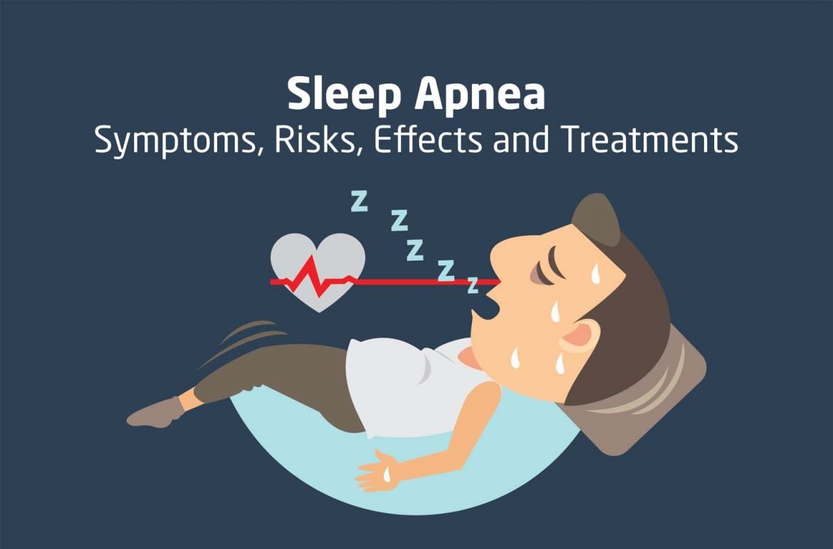 Sleeping Solutions; Obstructive Sleep Apnea Symptoms