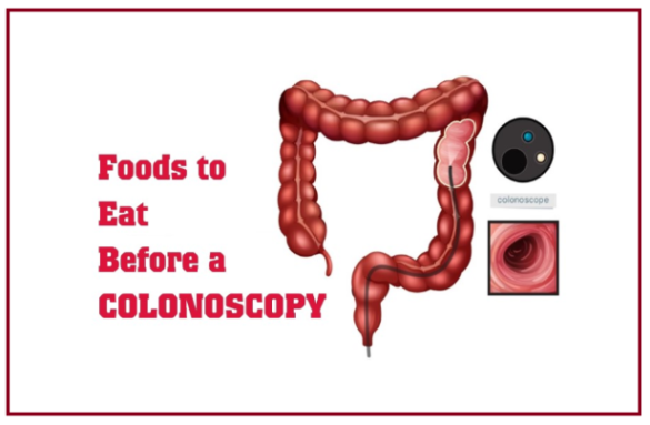 Foods To Eat Before A Colonoscopy